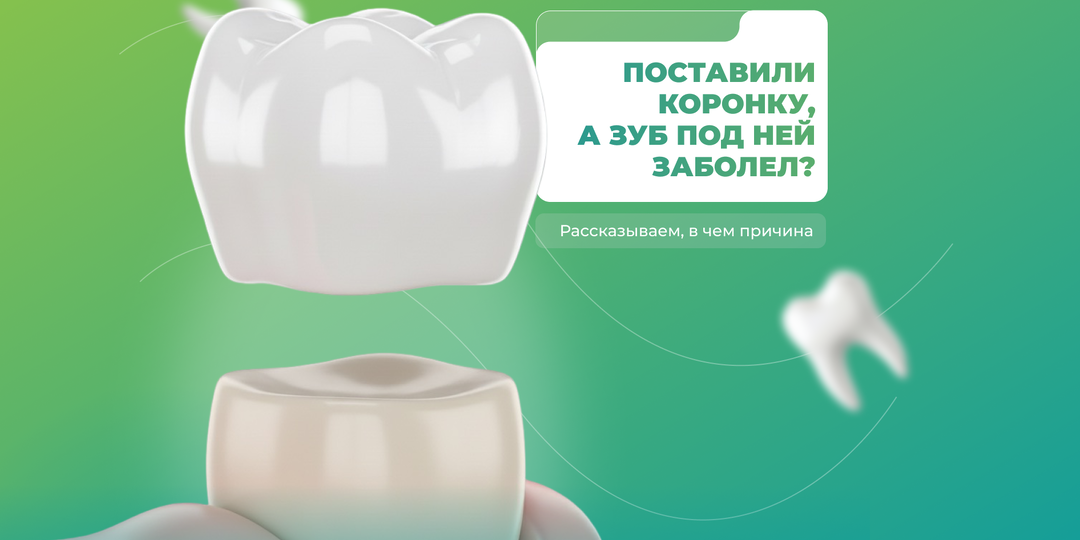 Как правильно подготовить зуб к коронке, чтобы она прослужила как можно дольше