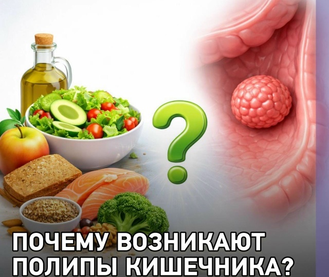 Почему возникают полипы в кишечнике?