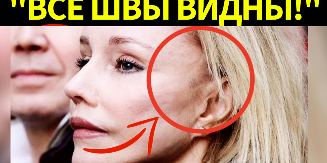 Жертва пластики! В сети активно обсуждают неудачную пластику Марины Зудиной вместо Дня памяти Табакова