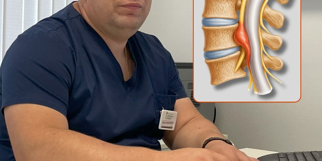 Стеноз позвоночного канала — это когда пространство, где проходит спинной мозг и нервные корешки, становится уже, чем должно быть