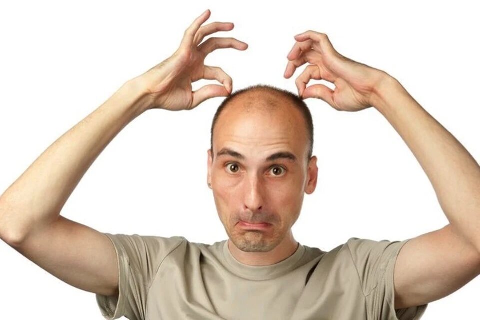 Генетики учатся предсказывать судьбу мужской шевелюры.