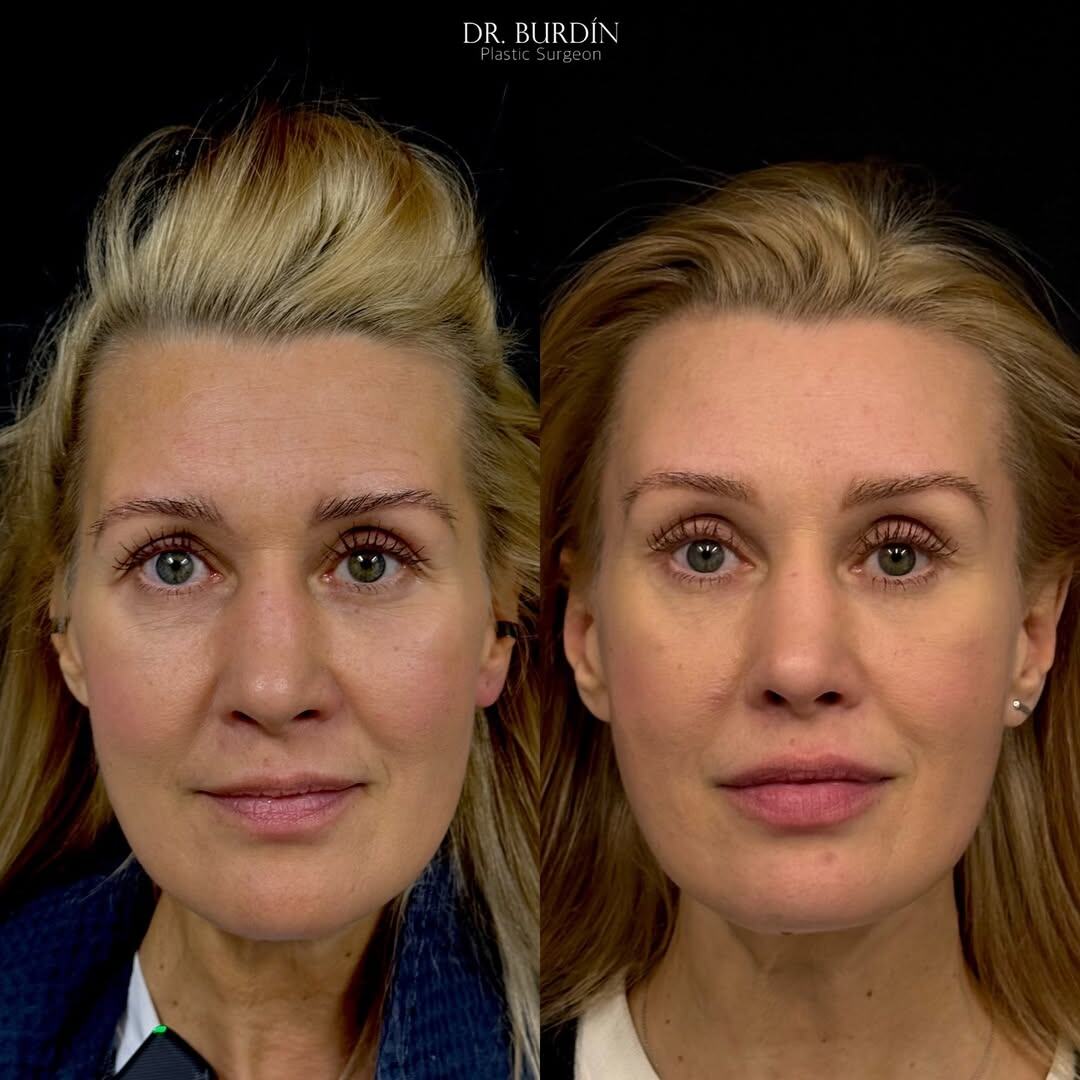 Пластический хирург клиники Форма Бурдин С.А.