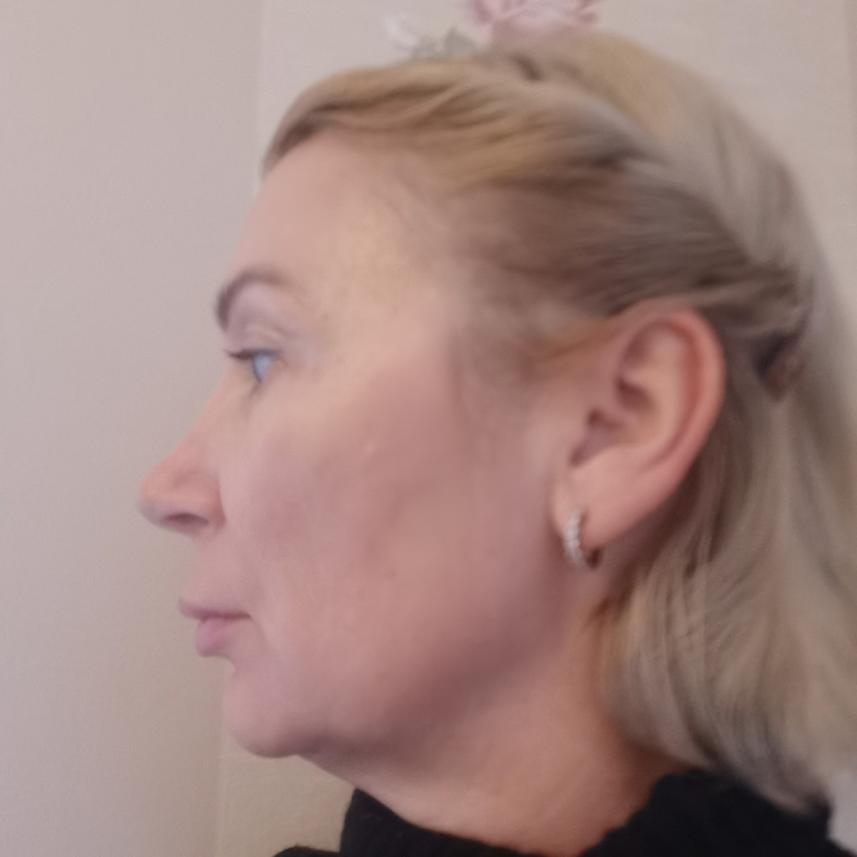 Это я, вид сбоку. Видите, какое провисание? 