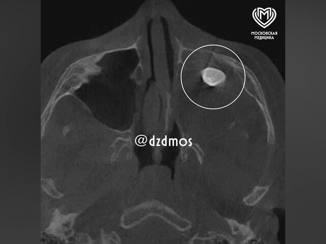    Фото: телеграм-канал "Московская медицина"