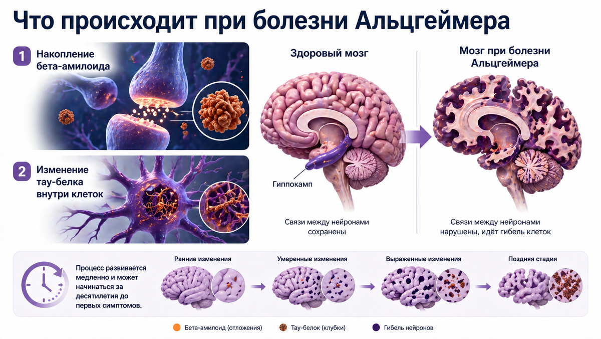 Фото: Хатуна Колбая