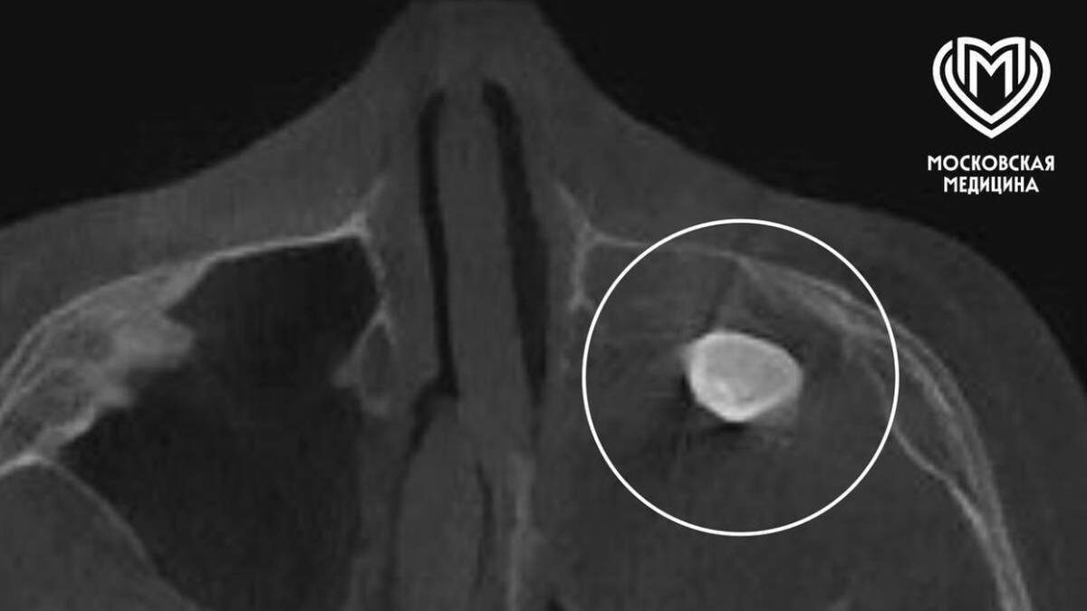    Фото: Telegram / Московская медицина