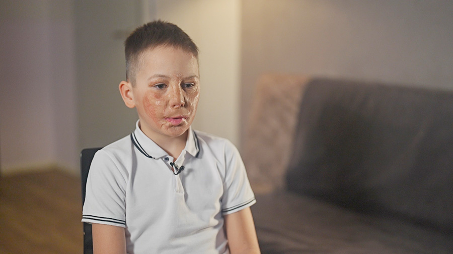 Зрители ТВЦ собирают средства на лечение Искандера Ялмамбетова