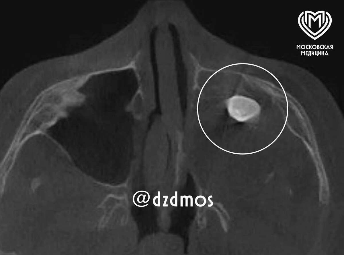     / Источник: © Telegram-канал «Официальные новости Московской медицины»