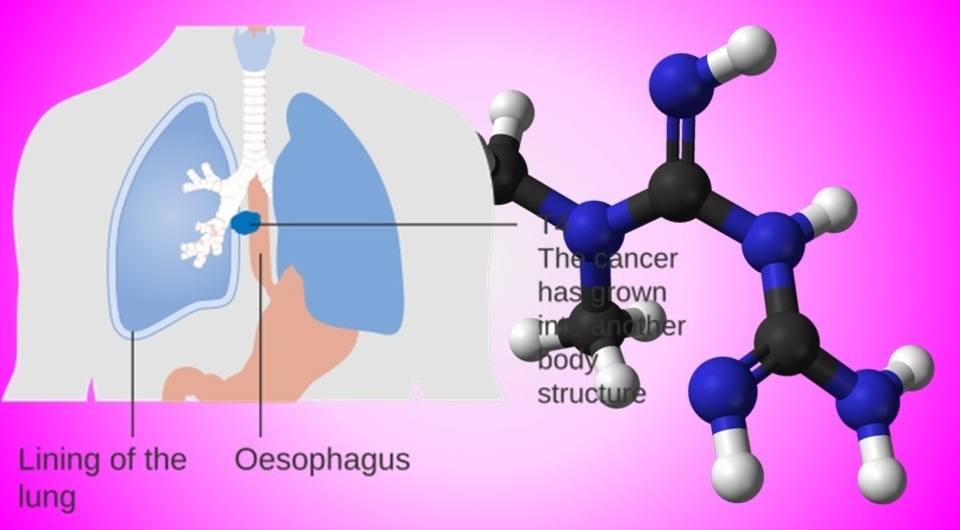   N + 1; Cancer Research UK / Wikimedia Commons / CC-BY-SA-4.0; Ben Mills / Wikimedia Commons / Public Domain