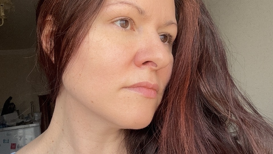 А у самой‑то всё лицо в ботоксе, филлеры в скулах, а овал явно скорректирован нитями