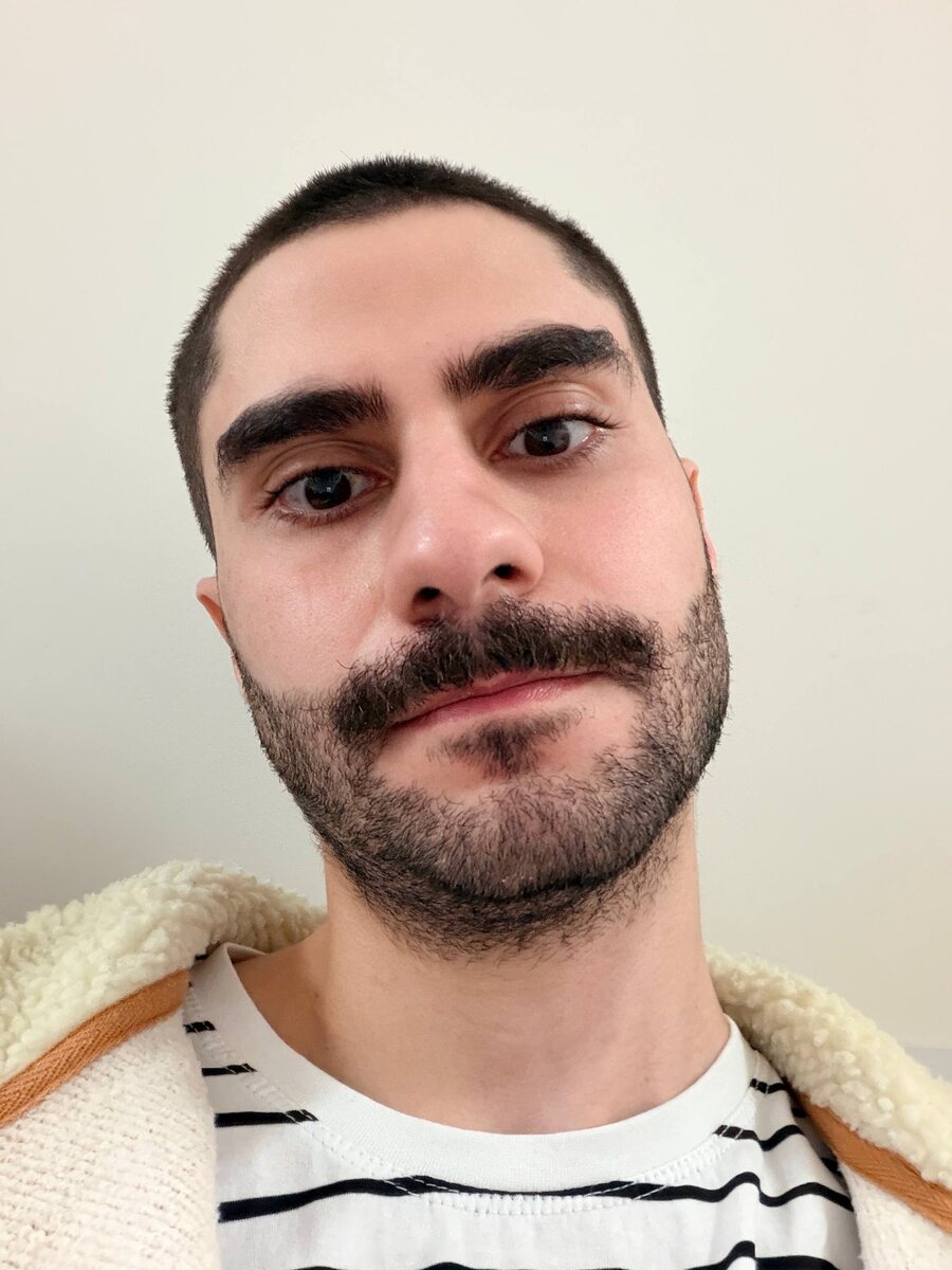 а это я с раширенными зрачками после капель 