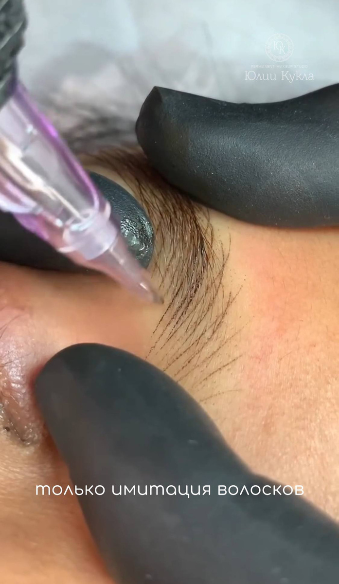 Процесс волосковой аппаратной техники