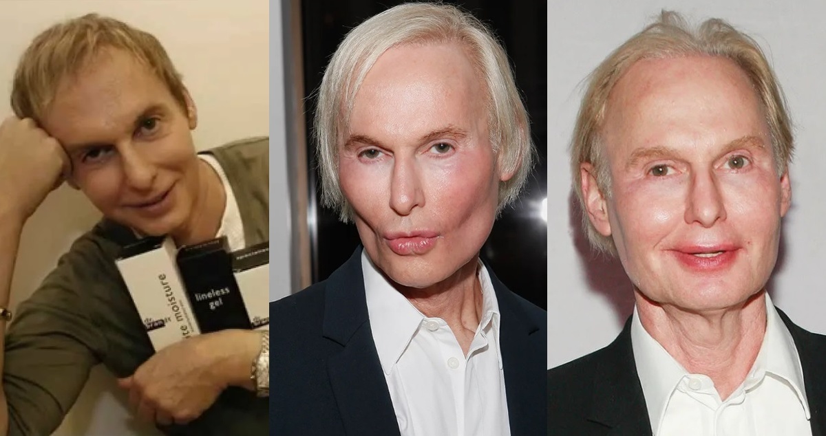 Доктор Брандт попал в собственную ловушку омоложения. Фото: соцсети