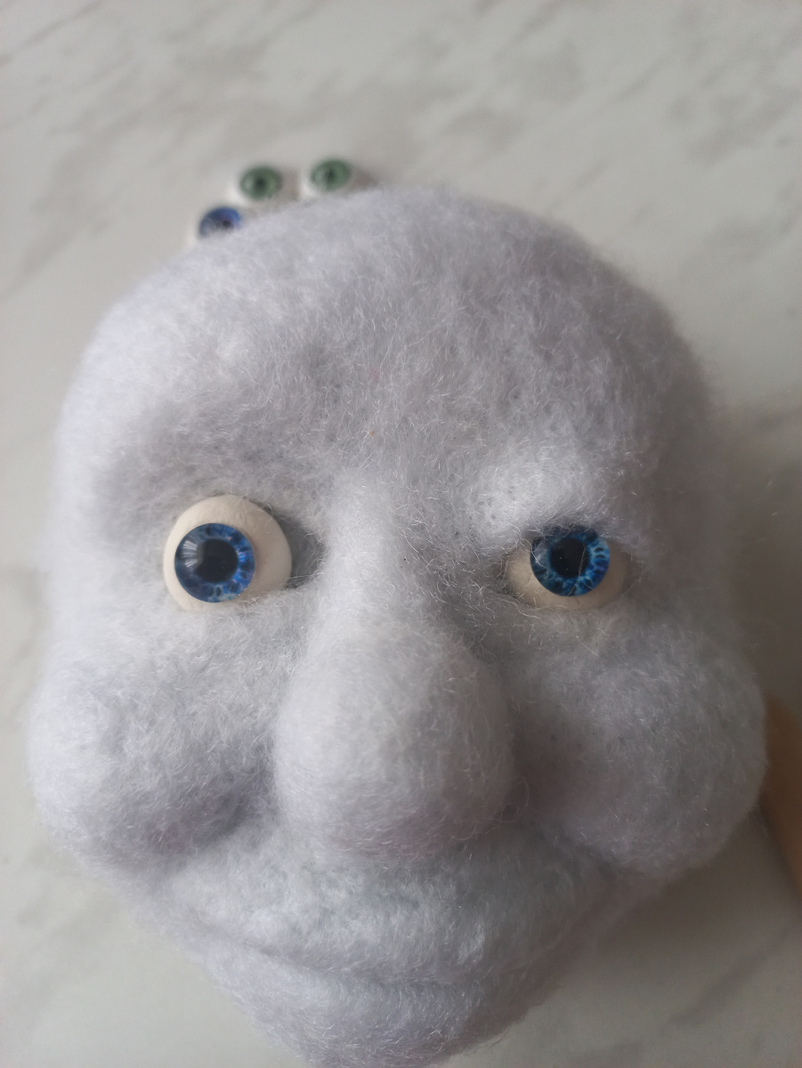 Фото автора . Без века один глаз, другой с верхним веком