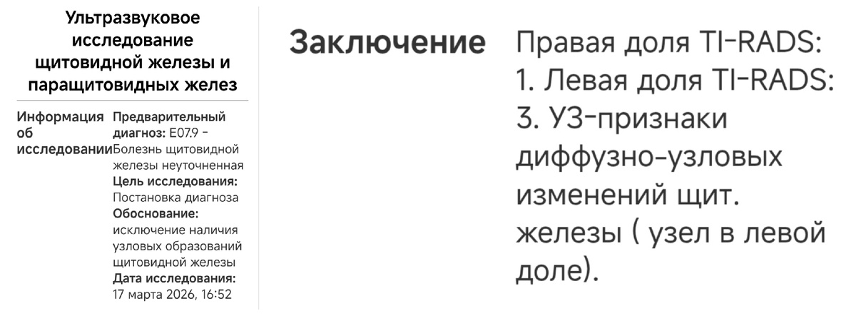 Скриншот из ЕМИАС.