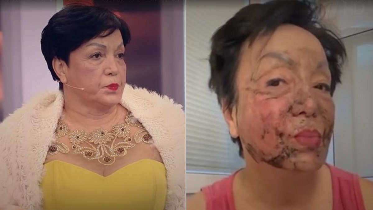 Скриншот программы «Пусть говорят» / женщине с пылесосом 60 лет, Лала Гадиева / экстремальное омоложение