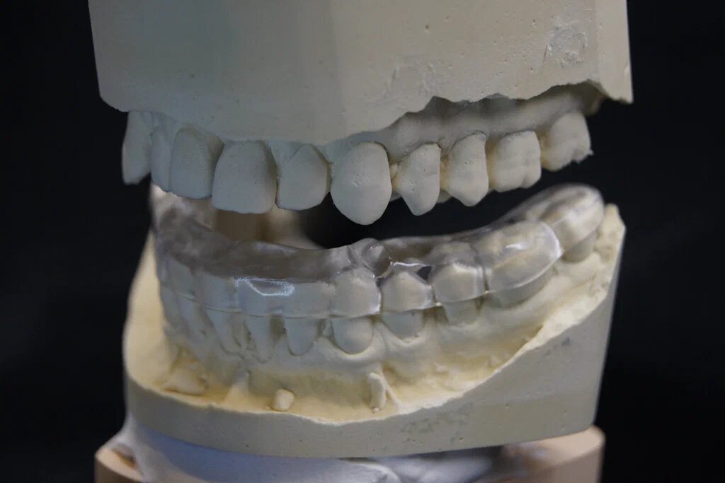 Внешне отличия стоматологических шин малозаметны и понятны только для стоматолога