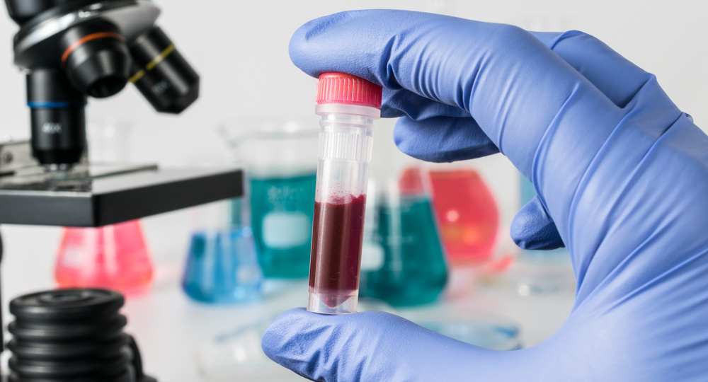 Какими анализами проверять щитовидку и как их понимать