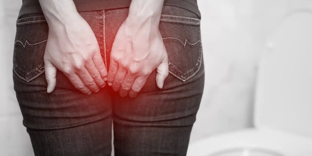 Нужно ли удалять геморрой?