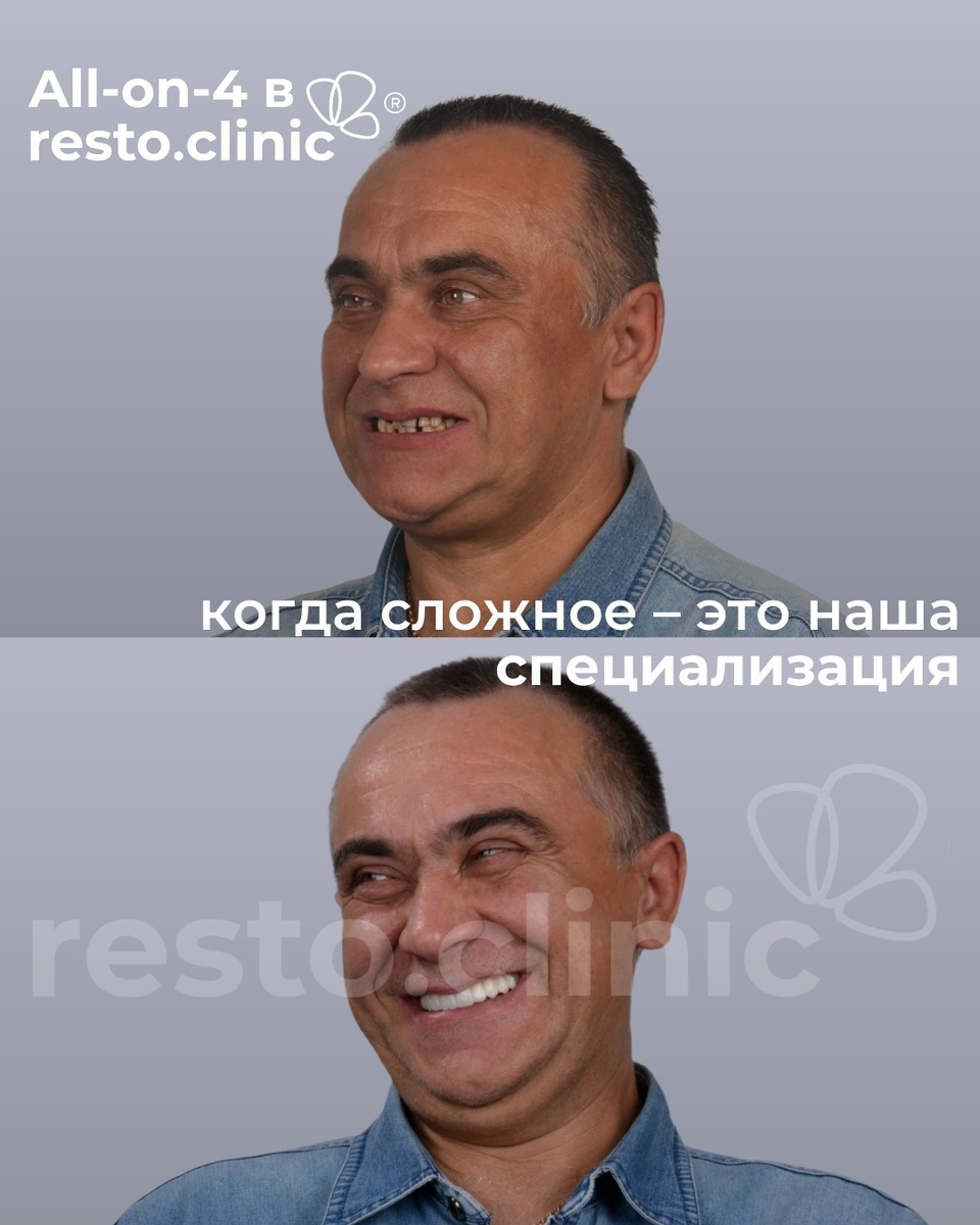 Стоматологическая клиника Ресто в Ижевске