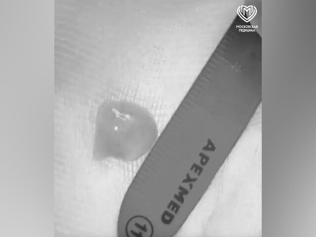    Фото: МАХ/"Московская медицина"