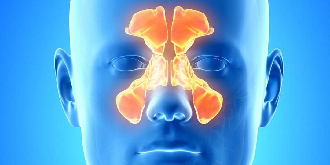 Гайморит, который не отпускает: почему нос заложен годами и как с этим жить