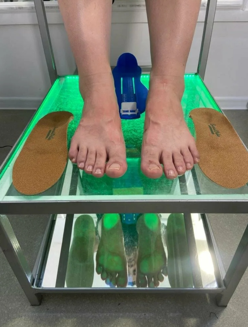 Подбор и изготовление стелек после диагностики на подоскопе