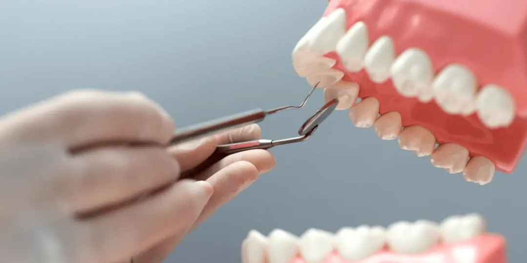 «Тихая бомба» в челюсти: почему киста зуба не болит, но требует срочного лечения