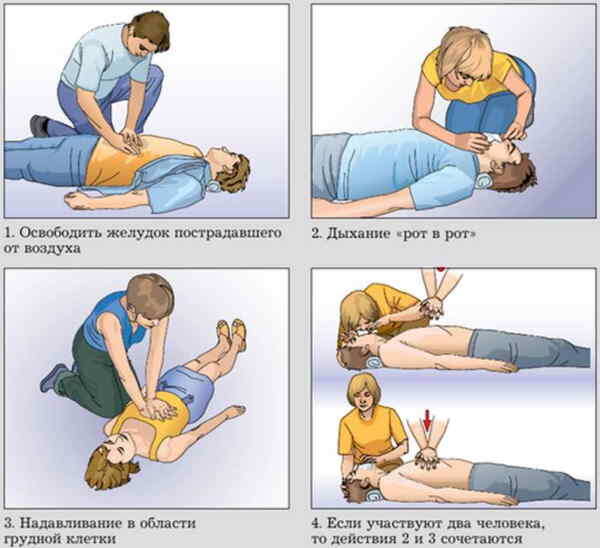 Как делать искусственное дыхание ребенку