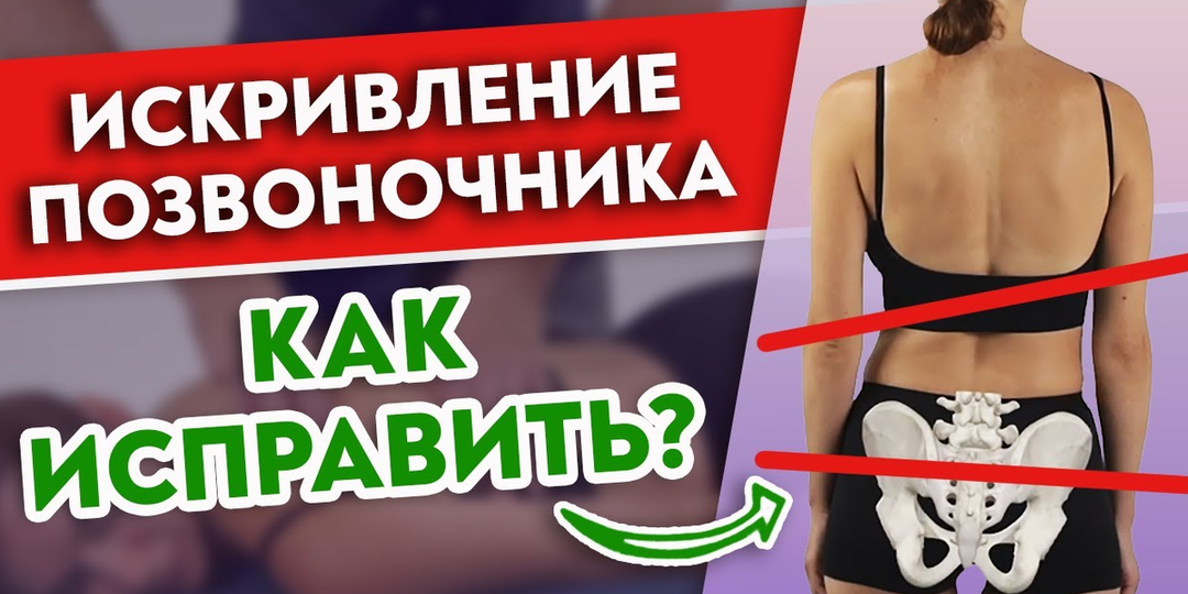 Как исправить искривление позвоночника и перекос таза?