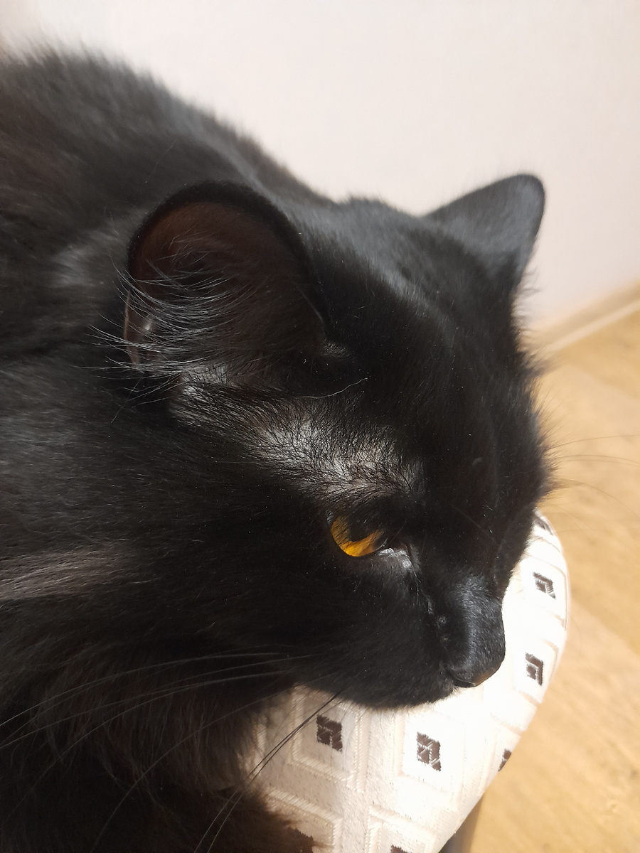 А вот так залысины выглядят сбоку. Контраст особенно заметен.