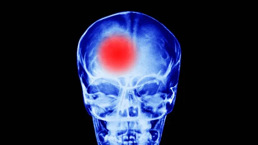    Источник: russian.rt.com Денис Сорокин