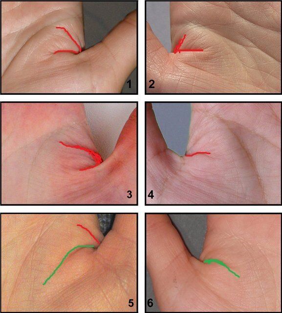 Драконовы линии обведены красным, они идут в сторону линии жизни, перпендикулярно линии жизни. На фото 5 и 6 красная - драконова линия, зелёные - защитные линии Марса. В отличие от драконовых линий, линия Марса всегда дугой наклонена вниз и идёт параллельно линии жизни (а не перпендикулярно ей). При вращении большим пальцем драконовы линии не исчезают (в отличие от обычных кожных складок). Фото с сайта Кристалл духа, обработка моя. 