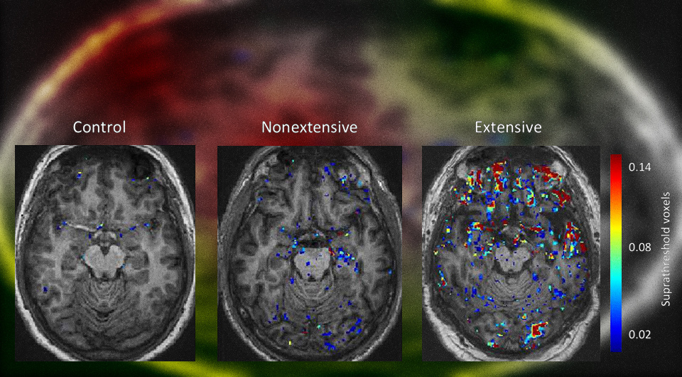   N + 1 / Greene et al. / Science Translational Medicine, 2026