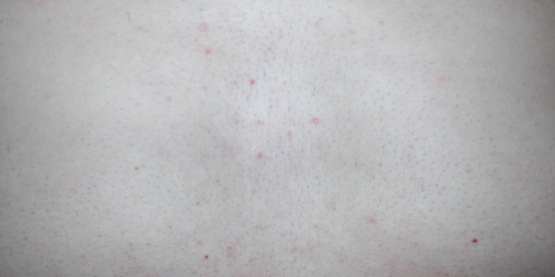 Этот Сигнал На Коже Может Появляться При Внутренних Проблемах