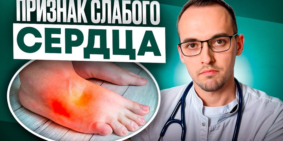 Этот Признак Может Появиться Задолго До Проблем С Сердцем