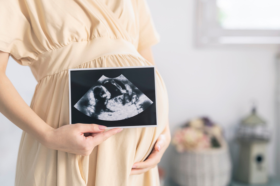    Shutterstock/FOTODOM