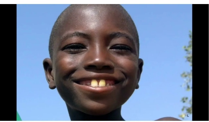 Кукурузозубы)