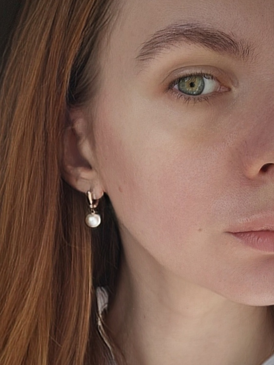 У меня на крыльях носа до сих остались метки от сосудов, но это небо и земля в сравнении с тем, что было изначально — фиолетовые жилки