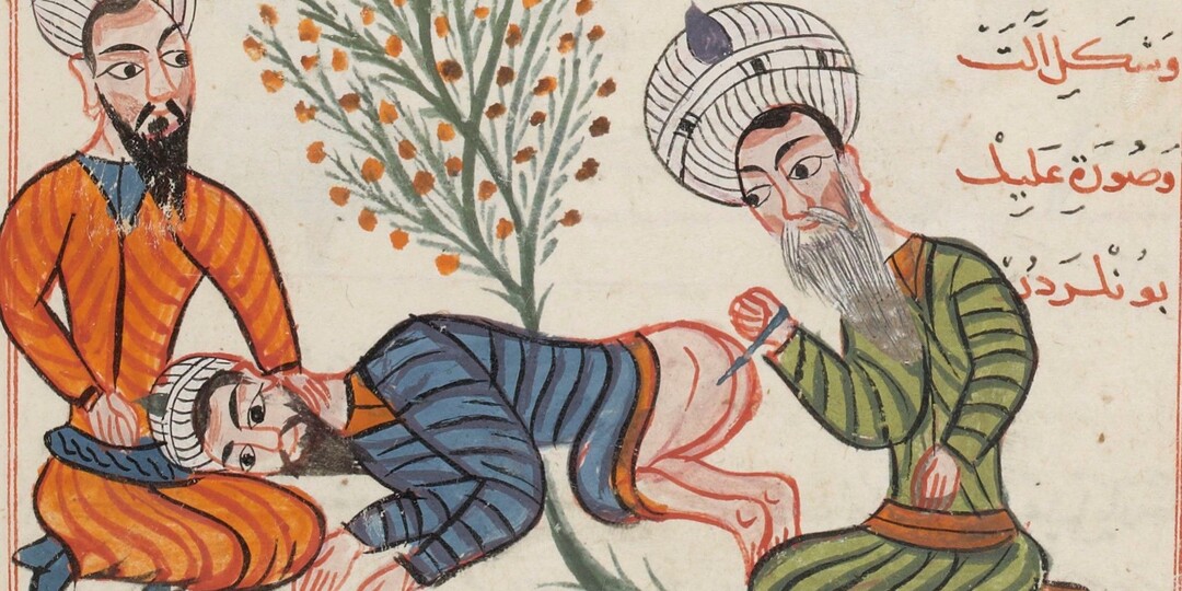 5 шокирующих методов лечения османских врачей. Не для слабонервных