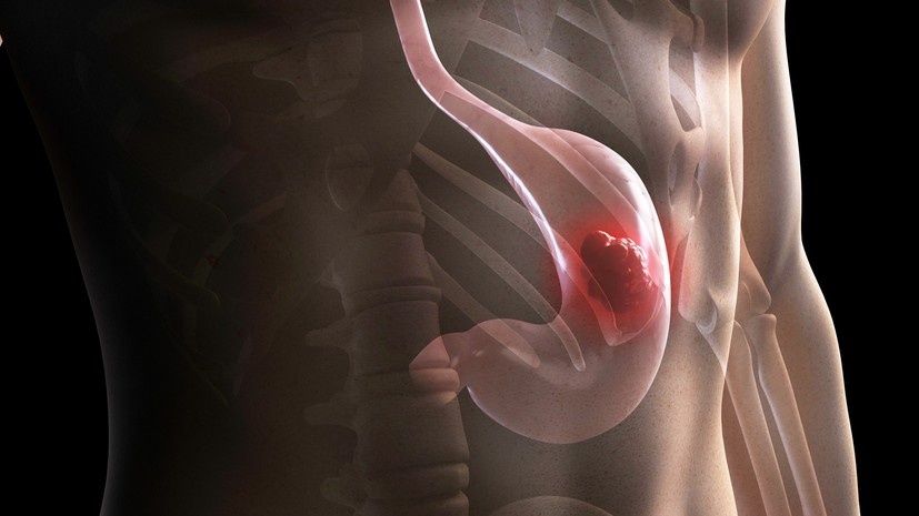   Gettyimages.ru Science Photo Library - SCIEPRO