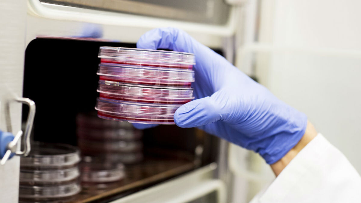    Клетки рака