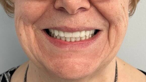 Результат реабилитации