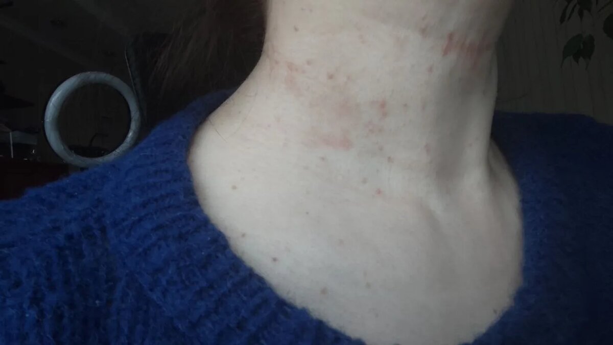 Такое фото нам прислали (публикуем с согласия девушки)