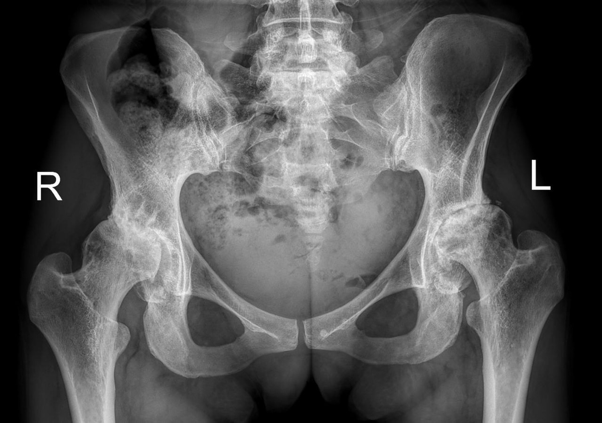 Снимок до операции 