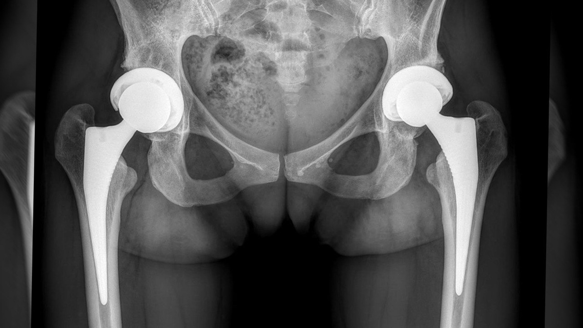 После операции