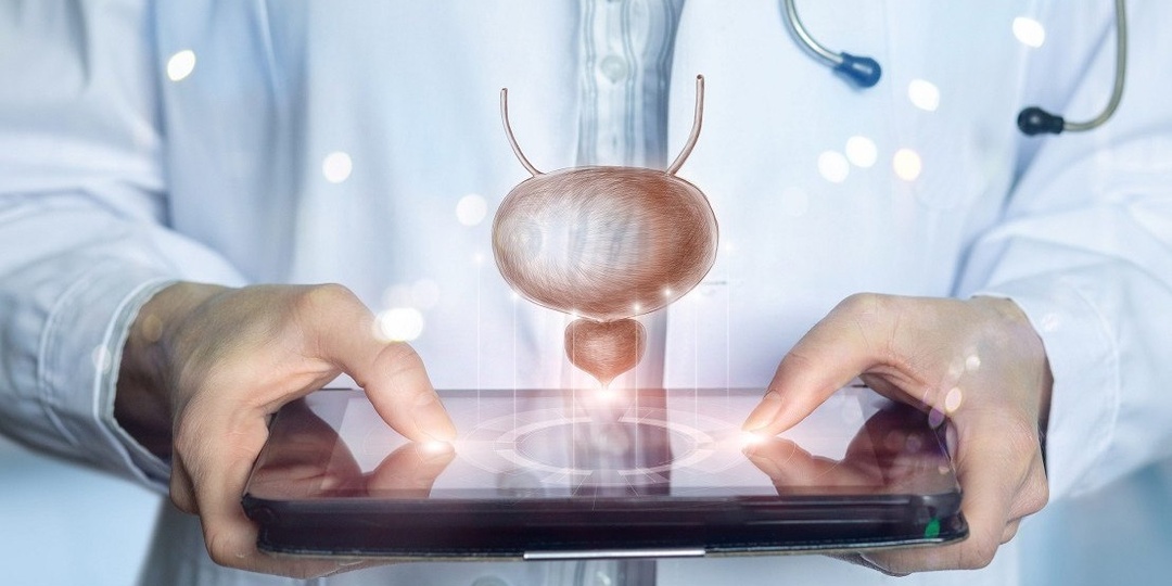 Ученые из Техасского университета оценили связь уровня тестостерона с риском прогрессирования рака предстательной железы