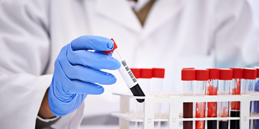 Медицинские обследования после 40 лет: заботьтесь о здоровье вовремя