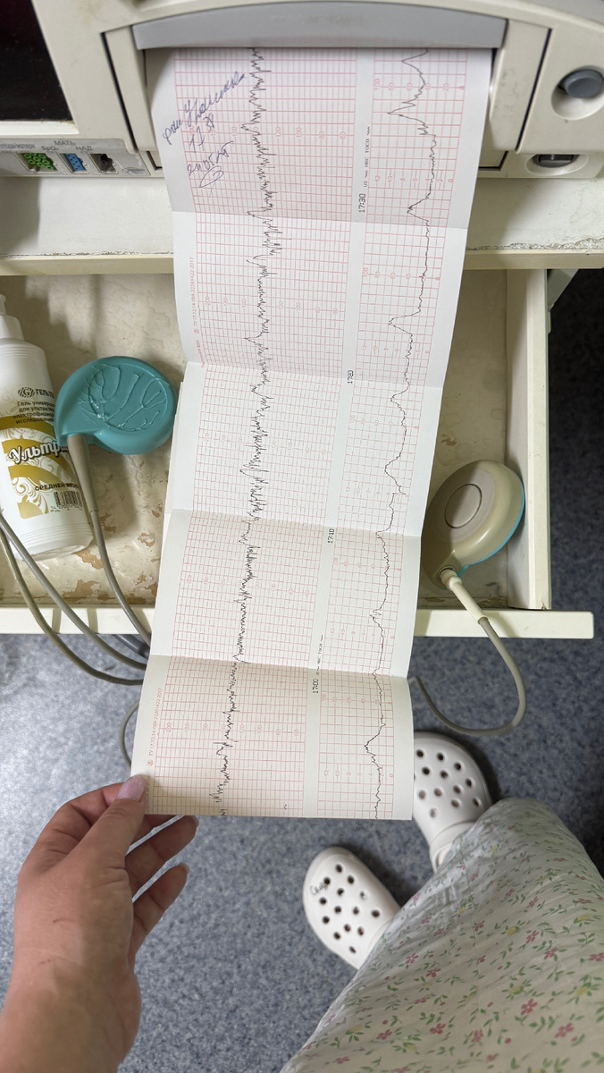 КТГ показывал, что родами даже и не пахнет еще совсем