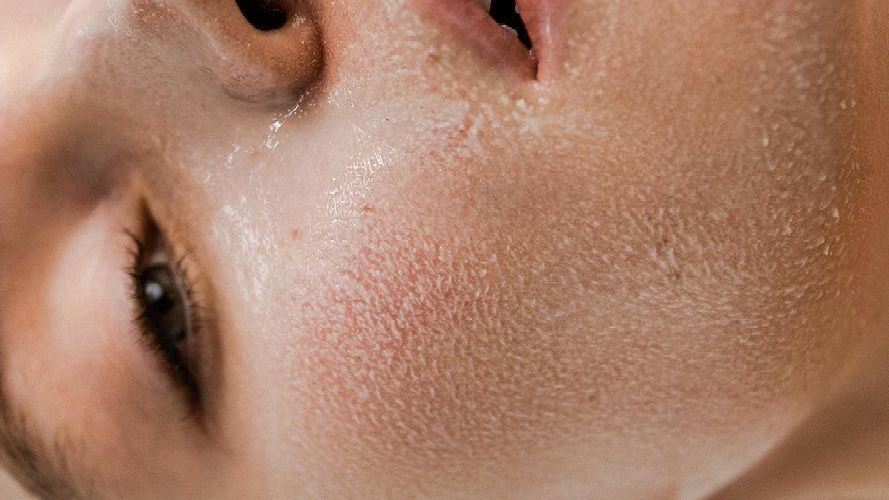 Кожа весной особенно уязвима! Истощена и сухая требует особого ухода и питания 